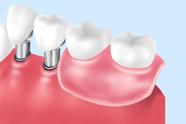 目黒区、都立大学の歯医者、あさの歯科クリニック
