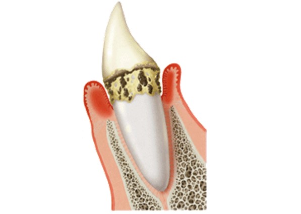 目黒区、都立大学の歯医者、あさの歯科クリニック