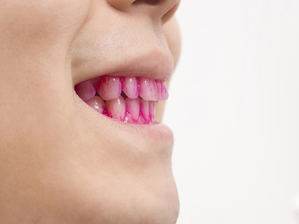 目黒区、都立大学の歯医者、あさの歯科クリニック