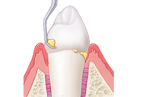 目黒区、都立大学の歯医者、あさの歯科クリニック