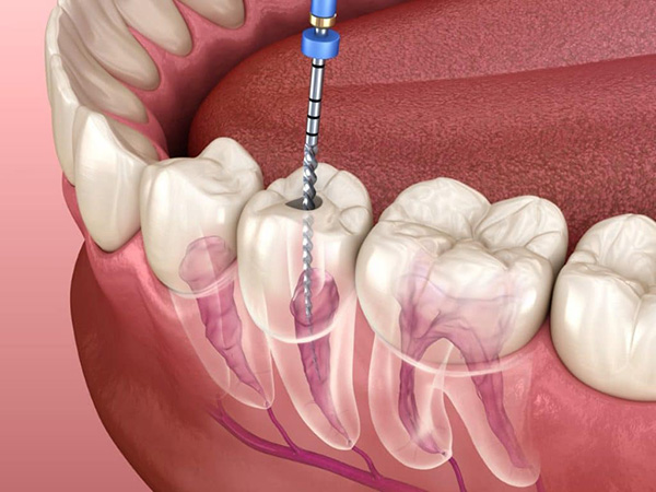 都立大学の歯医者、あさの歯科クリニック